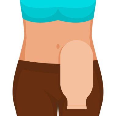 Young woman with colostomy bag. Vector illustration clipart