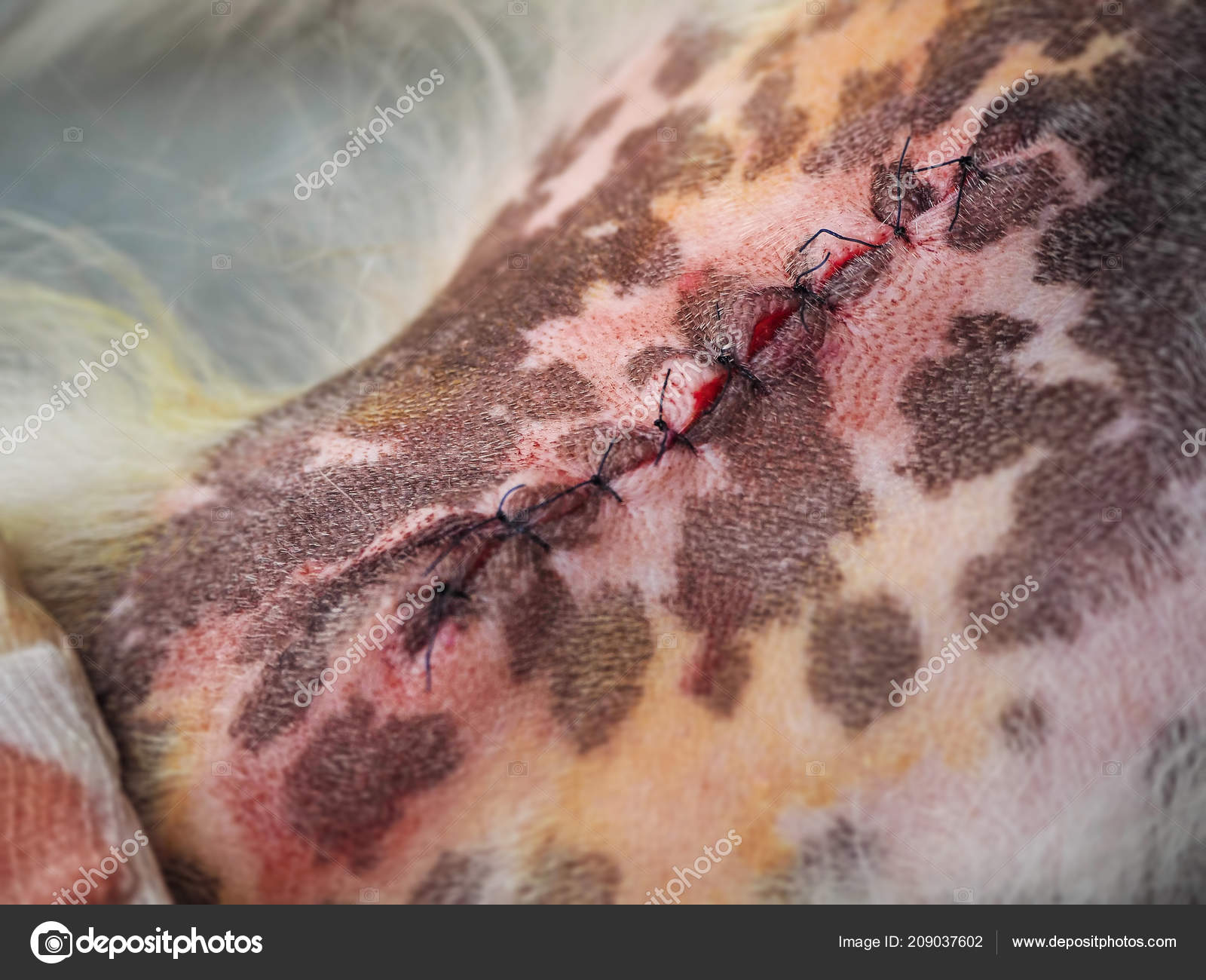 Suturing Stitches Pictures Suturing Stitches Stock Photos Images Depositphotos