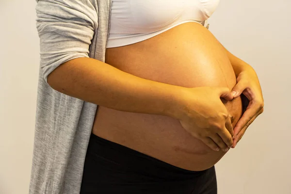 Mulher Grávida Mostrando Barriga Expandida Gravidez Padrão Abdominal Pele Esticada — Fotografia de Stock