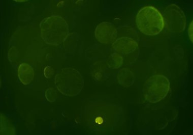 parlayan parlak bokeh parlayan parıltılar