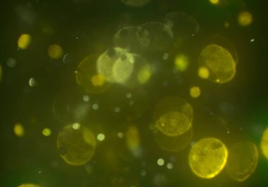 deffocused bokeh daireler ışıkları arka plan