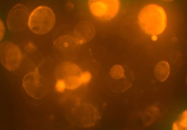 Bokeh ile soyut arkaplan