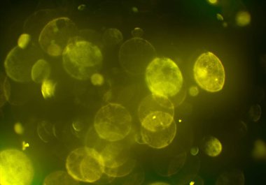 Bokeh ile soyut arkaplan