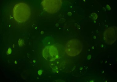 Bokeh ışıkları ile soyut arkaplan