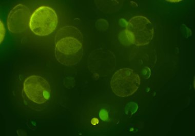 metin veya görüntü için alan ile bokeh arka plan