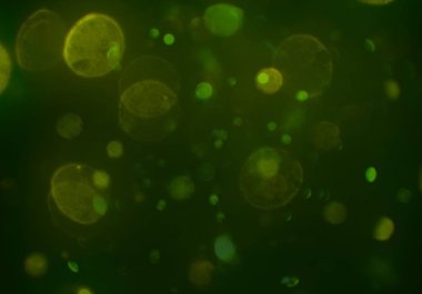 metin veya görüntü için alan ile bokeh arka plan