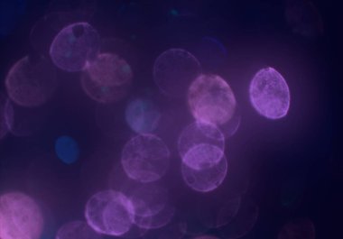 Bokeh ile soyut arkaplan