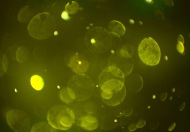 Bokeh ile soyut arkaplan