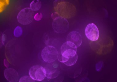 Bokeh ile soyut arkaplan