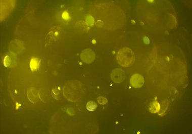 metin veya görüntü için alan ile bokeh arka plan