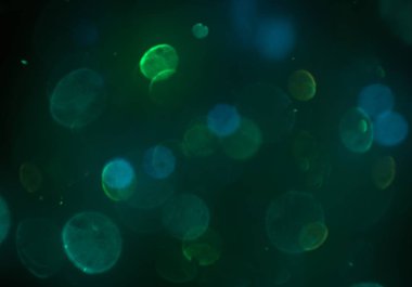 metin veya görüntü için alan ile bokeh arka plan