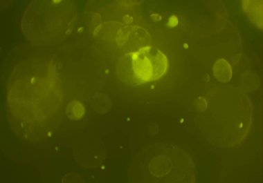 Bokeh ile soyut arkaplan