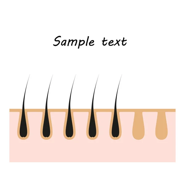 Icona illustrazione dei capelli della pelle. Elemento vettoriale su sfondo isolato per progetti di depilazione estetica, medicina con spazio per testo . — Vettoriale Stock