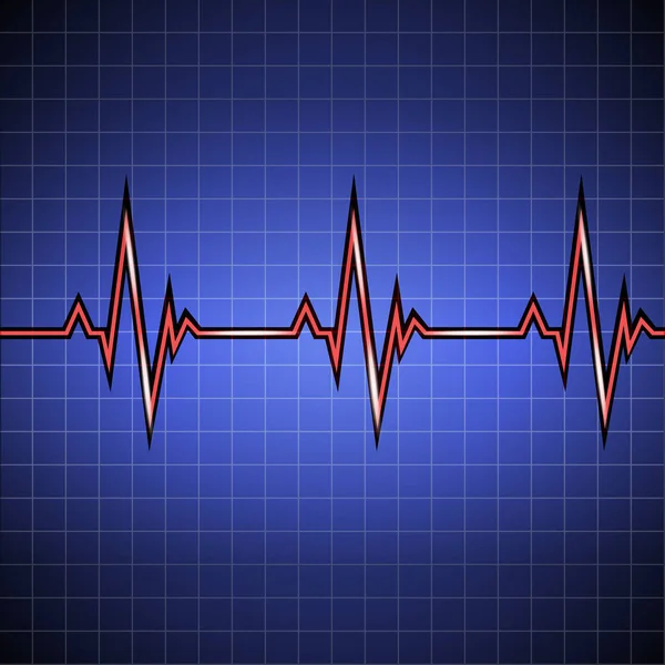 Παλμός. Καρδιογράφημα στην οθόνη στο κελί. Δεδομένα του καρδιακού ρυθμού. Εικονογραφήσεις φορέα. — Διανυσματικό Αρχείο