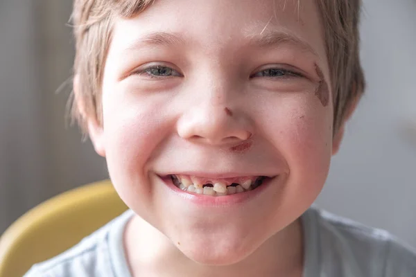 歯のない男の子が微笑む — ストック写真