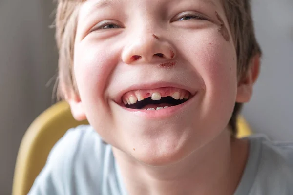 Szczerbaty chłopiec uśmiechający się — Zdjęcie stockowe