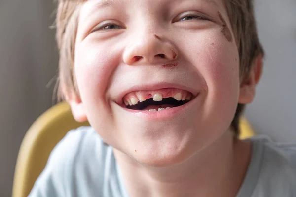 Menino desdentado sorrindo — Fotografia de Stock