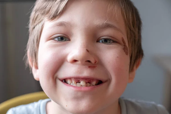 Menino desdentado sorrindo — Fotografia de Stock