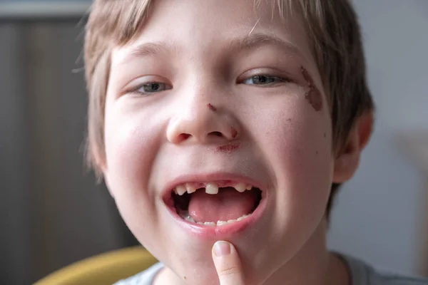 Menino desdentado sorrindo — Fotografia de Stock