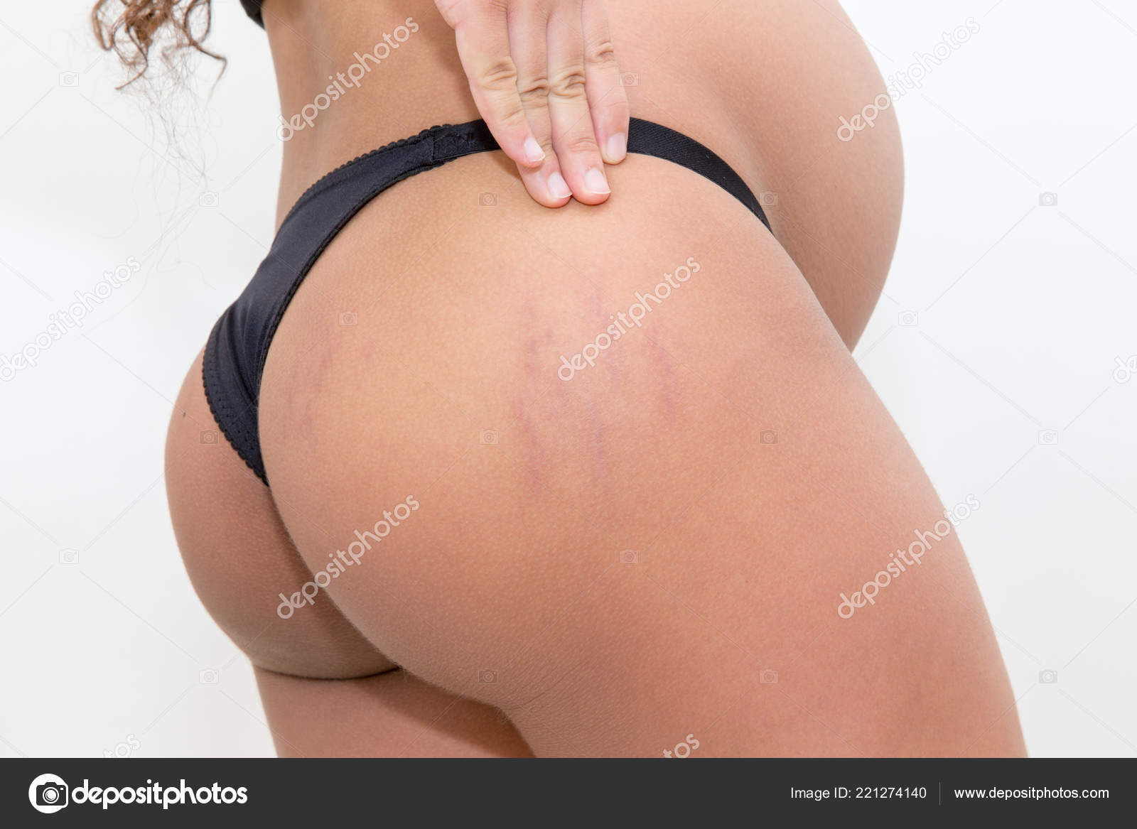 Download - Closeup of a pregnant woman with stretch marks on the buttocks. 