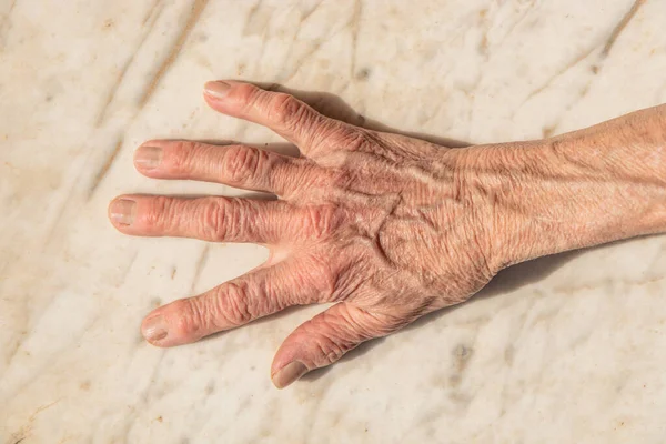 Faltige Und Gealterte Hand Einer Älteren Frau Die Auf Eine — Stockfoto