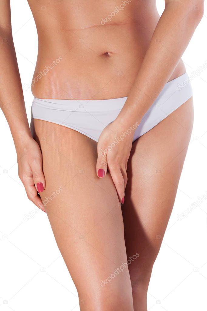 Woman cellulite and fat on thigh and stomach