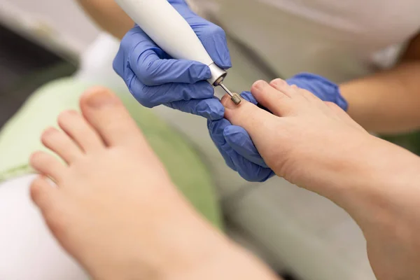 Patient on medical pedicure procedure — Stock Photo, Image