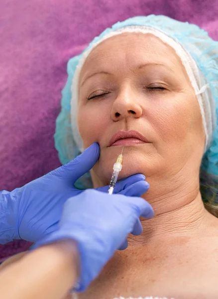 Mujer de mediana edad que recibe una inyección de botox — Foto de Stock