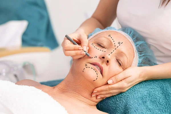 Procedimiento de rejuvenecimiento facial para la mujer mayor . —  Fotos de Stock