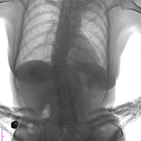 This X-ray shows the human body.