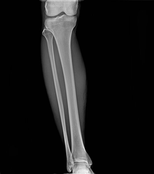 This X-ray shows the body.