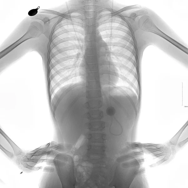 X-ray image of a human body wearing jewelry.