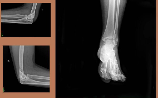 The image displays X-ray views of both an elbow and an ankle, highlighting their respective anatomical structures.