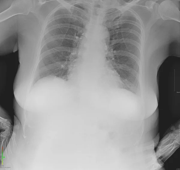 This image is a chest X-ray. Chest X-rays are primarily used to detect and diagnose problems related to the heart and lungs, as well as the bones of the chest.