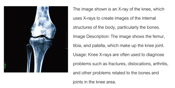 The image shown is an X-ray of the knee, which uses X-rays to create images of the internal structures of the body, particularly the bones