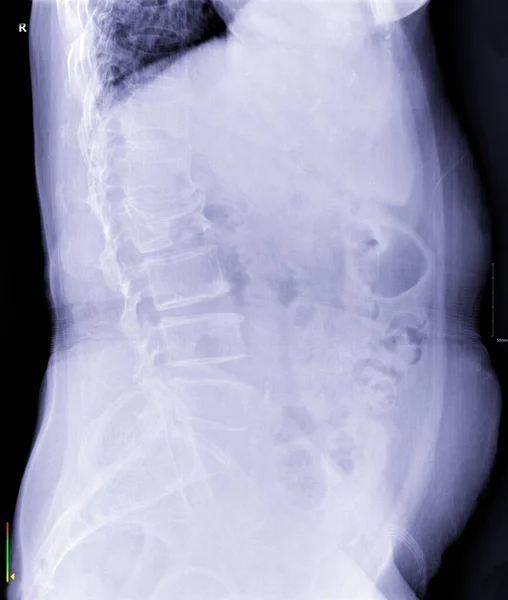 Side X-ray images for diagnosis.