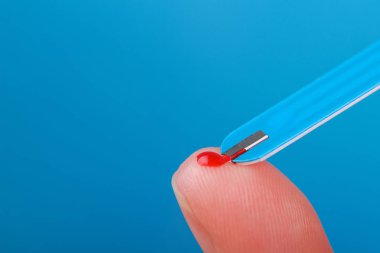 kan testi parmak, diyabet kavramı üzerinden yakın çekim