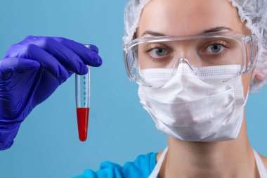 Bir asistan gözlük, medikal maske, medikal ürünler, laboratuvar üniforma bir tüp kan tutar. Laboratuvar, tıbbi testler ve araştırma.