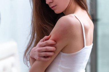 Young woman suffering from itching on her skin and scratching an clipart