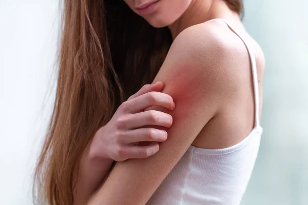 Young woman suffering from itching on her skin and scratching an — Stock Photo, Image