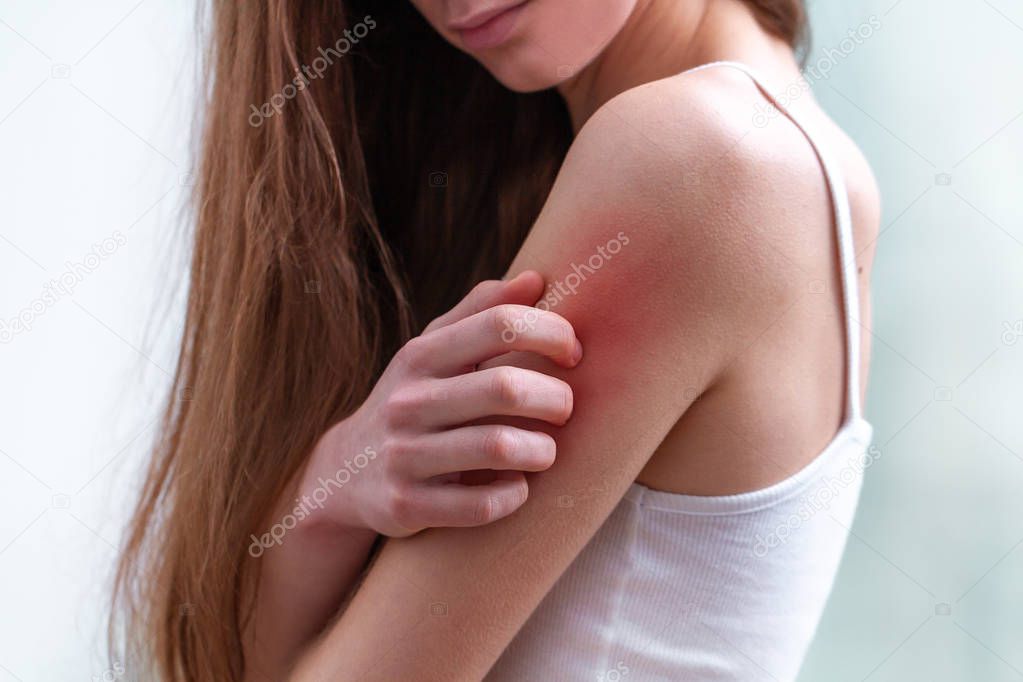 Young woman suffering from itching on her skin and scratching an