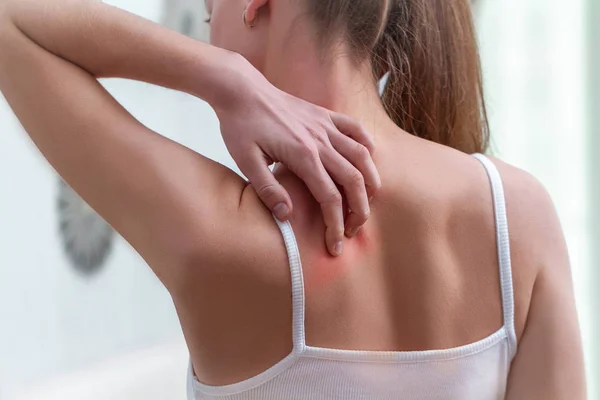 Young woman suffering from itching on her skin and scratching an — Stock Photo, Image