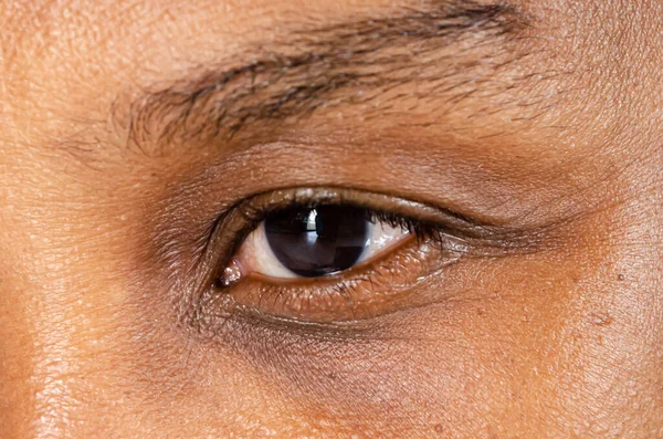 Thin wide layer of eyebrow is over an open relaxed left eye with white around the carnea and light from an open entrance reflects vertically across the pupil.