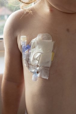 Bir tıp bağlantı noktası 