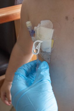 Bir tıp bağlantı noktası 