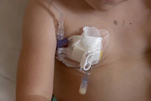 Bir tıp bağlantı noktası 