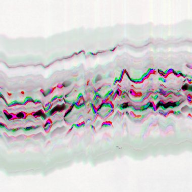 Dijital ekran aksaklık etkisi doku soyut. 