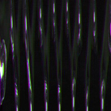 Dijital ekran aksaklık etkisi doku soyut. 