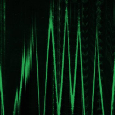 Dijital ekran aksaklık etkisi doku soyut. Yeşil ve siyah