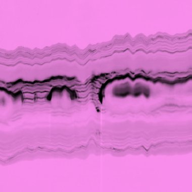 Dijital ekran aksaklık etkisi doku soyut. Pembe ve siyah